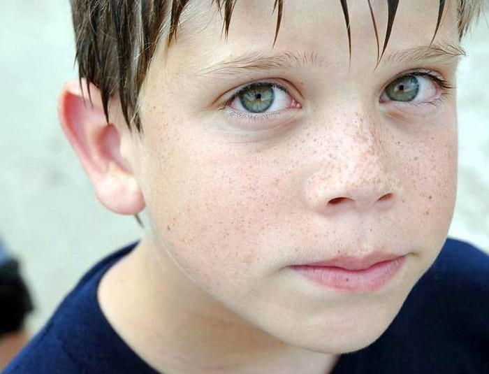 Rothaarige sommersprossigen Rotschopf