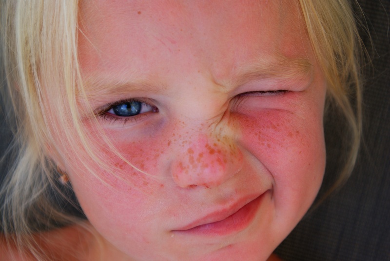 auf den Wangen Weg von der Sonne