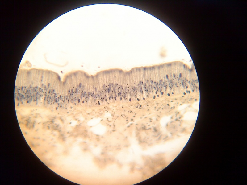 Single-Layer multirowed