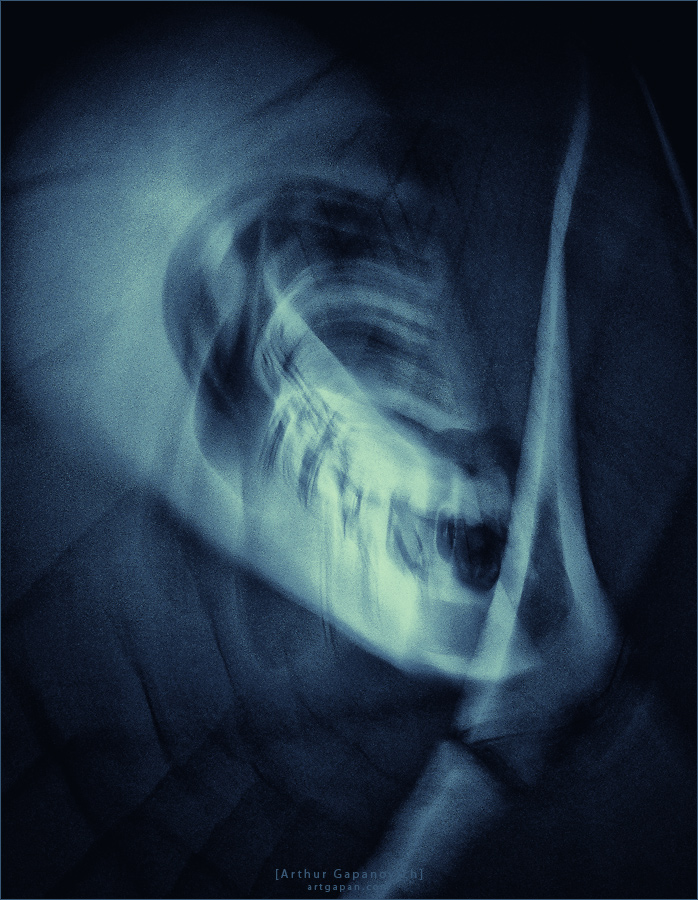 [Dark side of ze tsYrk] *- 1