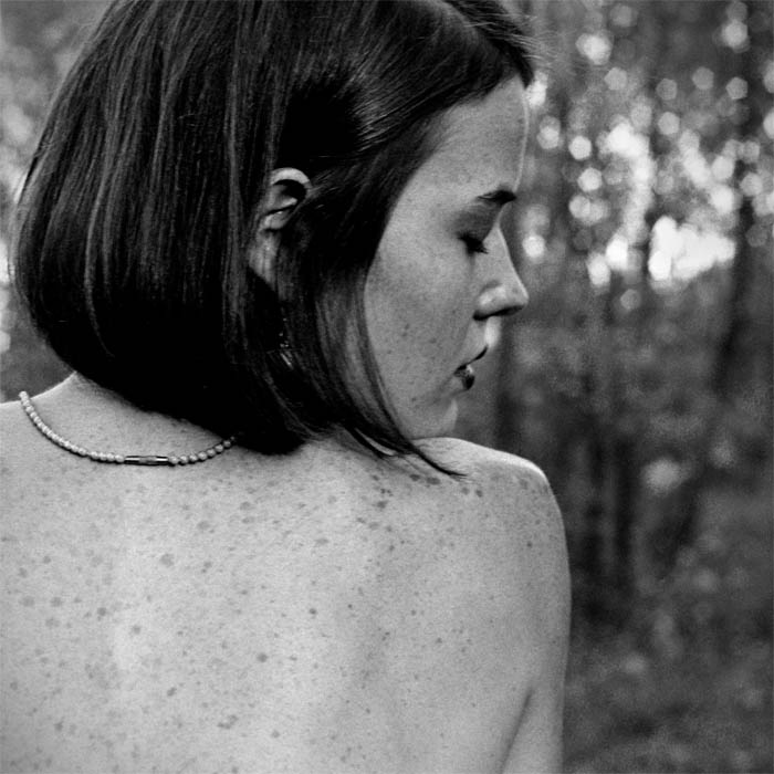 epigastrischen Depression